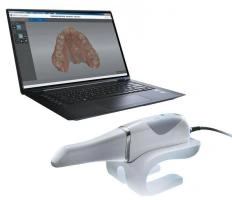 Digital impression scanner