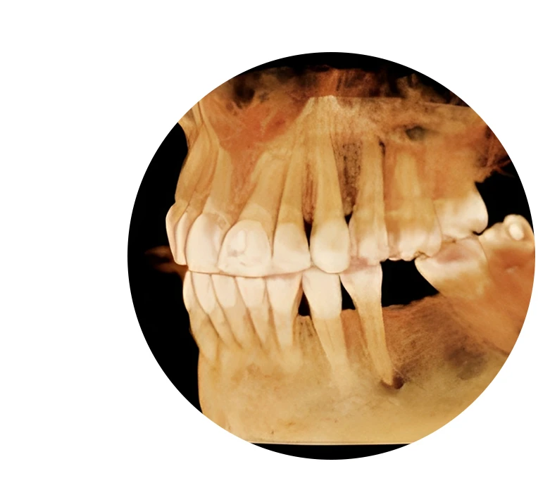 Dental CT Scan
