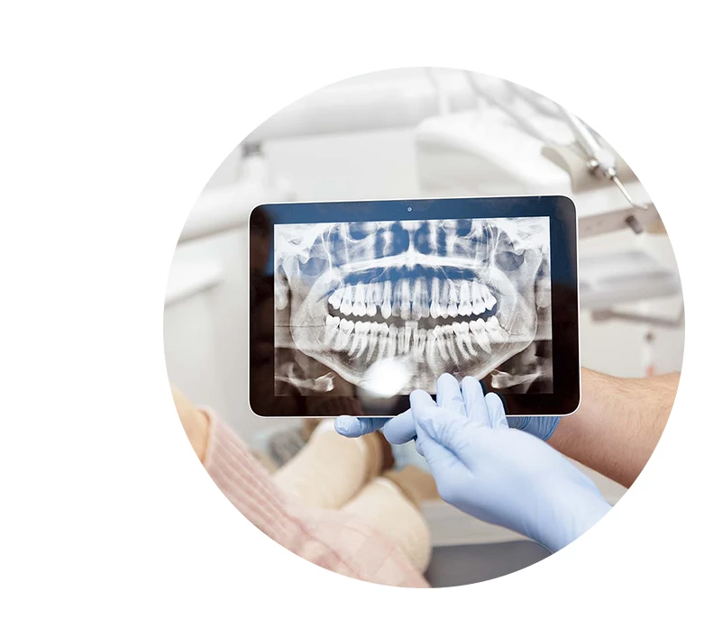 Cropped shot of a professional dentist showing jaws and teeth x-rays to his patient